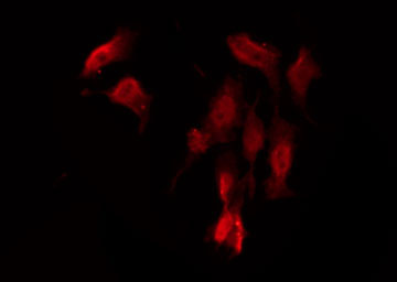GPRC6A Antibody - Staining HeLa cells by IF/ICC. The samples were fixed with PFA and permeabilized in 0.1% Triton X-100, then blocked in 10% serum for 45 min at 25°C. The primary antibody was diluted at 1:200 and incubated with the sample for 1 hour at 37°C. An Alexa Fluor 594 conjugated goat anti-rabbit IgG (H+L) Ab, diluted at 1/600, was used as the secondary antibody.