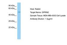GPRIN2 / GRIN2 Antibody -  This image was taken for the unconjugated form of this product. Other forms have not been tested.