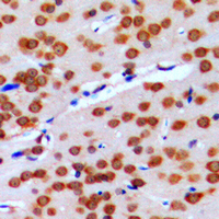 GPRIN2 / GRIN2 Antibody - Immunohistochemical analysis of GPRIN2 staining in human brain formalin fixed paraffin embedded tissue section. The section was pre-treated using heat mediated antigen retrieval with sodium citrate buffer (pH 6.0). The section was then incubated with the antibody at room temperature and detected using an HRP conjugated compact polymer system. DAB was used as the chromogen. The section was then counterstained with hematoxylin and mounted with DPX.