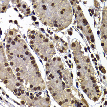 GPS1 / CSN1 Antibody - Immunohistochemistry of paraffin-embedded human stomach tissue.