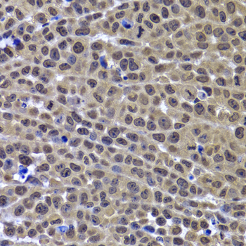 GPS1 / CSN1 Antibody - Immunohistochemistry of paraffin-embedded mouse cancer tissue.