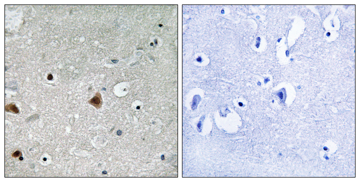 GPS1 / CSN1 Antibody - Immunohistochemistry analysis of paraffin-embedded human brain, using COPS1 (Phospho-Ser454) Antibody. The picture on the right is blocked with the phospho peptide.