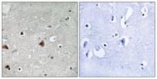 GPS1 / CSN1 Antibody - Immunohistochemistry analysis of paraffin-embedded human brain, using COPS1 (Phospho-Ser454) Antibody. The picture on the right is blocked with the phospho peptide.