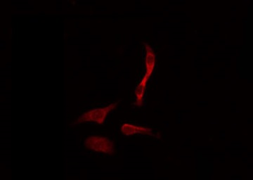 GPS2 Antibody - Staining HeLa cells by IF/ICC. The samples were fixed with PFA and permeabilized in 0.1% Triton X-100, then blocked in 10% serum for 45 min at 25°C. The primary antibody was diluted at 1:200 and incubated with the sample for 1 hour at 37°C. An Alexa Fluor 594 conjugated goat anti-rabbit IgG (H+L) Ab, diluted at 1/600, was used as the secondary antibody.