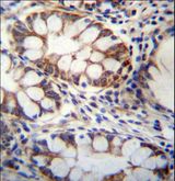 GPSM1 / AGS3 Antibody - GPSM1 Antibody immunohistochemistry of formalin-fixed and paraffin-embedded human rectum tissue followed by peroxidase-conjugated secondary antibody and DAB staining.
