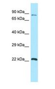 GPSM1 / AGS3 Antibody - AGS3 antibody Western Blot of NCI-H226.  This image was taken for the unconjugated form of this product. Other forms have not been tested.