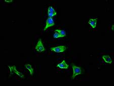 GPSM1 / AGS3 Antibody - Immunofluorescence staining of HepG2 cells with GPSM1 Antibody at 1:133, counter-stained with DAPI. The cells were fixed in 4% formaldehyde, permeabilized using 0.2% Triton X-100 and blocked in 10% normal Goat Serum. The cells were then incubated with the antibody overnight at 4°C. The secondary antibody was Alexa Fluor 488-congugated AffiniPure Goat Anti-Rabbit IgG(H+L).