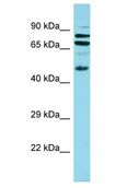 GPSM2 / LGN Antibody - GPSM2 / LGN antibody Western Blot of Fetal Small Intestine. Antibody dilution: 1 ug/ml.  This image was taken for the unconjugated form of this product. Other forms have not been tested.