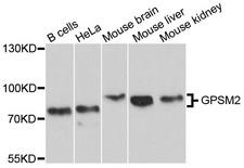 GPSM2 / LGN Antibody - Western blot analysis of extracts of various cell lines, using GPSM2 antibody at 1:1000 dilution. The secondary antibody used was an HRP Goat Anti-Rabbit IgG (H+L) at 1:10000 dilution. Lysates were loaded 25ug per lane and 3% nonfat dry milk in TBST was used for blocking. An ECL Kit was used for detection and the exposure time was 10s.
