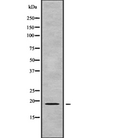 GPSM3 Antibody - Western blot analysis GPSM3 using COLO205 whole cells lysates