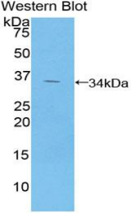 GPT / Alanine Transaminase Antibody - Western blot of recombinant GPT / Alanine Transaminase.  This image was taken for the unconjugated form of this product. Other forms have not been tested.