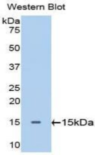 GPT / Alanine Transaminase Antibody - Western blot of recombinant GPT / Alanine Transaminase.  This image was taken for the unconjugated form of this product. Other forms have not been tested.