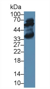 GPT / Alanine Transaminase Antibody - Western Blot; Sample: Rat Liver lysate; ;Primary Ab: 2µg/ml Rabbit Anti-Human ALT Antibody;Second Ab: 0.2µg/mL HRP-Linked Caprine Anti-Rabbit IgG Polyclonal Antibody;(Catalog: SAA544Rb19