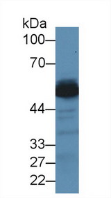 GPT / Alanine Transaminase Antibody - Western Blot; Sample: Mouse Liver lysate; ;Primary Ab: 2µg/ml Rabbit Anti-Human ALT Antibody;Second Ab: 0.2µg/mL HRP-Linked Caprine Anti-Rabbit IgG Polyclonal Antibody;