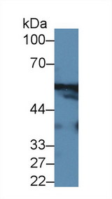 GPT / Alanine Transaminase Antibody - Western Blot; Sample: Mouse Cerebrum lysate; ;Primary Ab: 2µg/ml Rabbit Anti-Human ALT Antibody;Second Ab: 0.2µg/mL HRP-Linked Caprine Anti-Rabbit IgG Polyclonal Antibody;(Catalog: SAA544Rb19