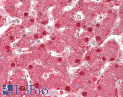 GPT / Alanine Transaminase Antibody - Human Liver: Formalin-Fixed, Paraffin-Embedded (FFPE).  This image was taken for the unconjugated form of this product. Other forms have not been tested.