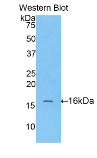 GPT / Alanine Transaminase Antibody - Western blot of recombinant GPT / Alanine Transaminase.  This image was taken for the unconjugated form of this product. Other forms have not been tested.
