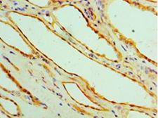 GPT / Alanine Transaminase Antibody - Immunohistochemistry of paraffin-embedded human kidney tissue using antibody at 1:100 dilution.  This image was taken for the unconjugated form of this product. Other forms have not been tested.