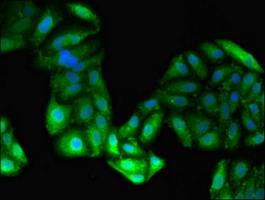 GPT / Alanine Transaminase Antibody - Immunofluorescent analysis of HepG2 cells using GPT Antibody at dilution of 1:100 and Alexa Fluor 488-congugated AffiniPure Goat Anti-Rabbit IgG(H+L)