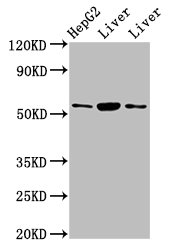GPT / Alanine Transaminase Antibody - Western Blot Positive WB detected in: HepG2 whole cell lysate, Rat liver tissue, Mouse liver tissue All lanes: GPT antibody at 4.5µg/ml Secondary Goat polyclonal to rabbit IgG at 1/50000 dilution Predicted band size: 55 kDa Observed band size: 55 kDa