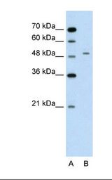 GPT / Alanine Transaminase Antibody - Lane A: Marker. Lane B: Jurkat cell lysate. Antibody concentration: 2.5 ug/ml. Gel concentration: 12%.  This image was taken for the unconjugated form of this product. Other forms have not been tested.