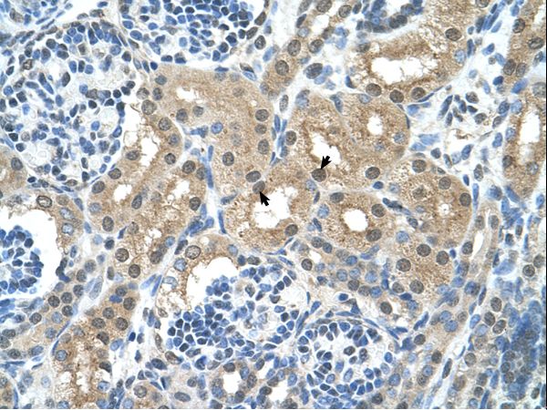 GPT / Alanine Transaminase Antibody - GPT / ALT1 antibody GPT(glutamic-pyruvate transaminase (alanine aminotransferase)) Antibody was used in IHC to stain formalin-fixed, paraffin-embedded human kidney.  This image was taken for the unconjugated form of this product. Other forms have not been tested.