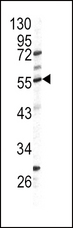 GPT / Alanine Transaminase Antibody - Western blot of GPT antibody (N-term P101) in HL60 cell line lysates (35 ug/lane). GPT (arrow) was detected using the purified antibody.