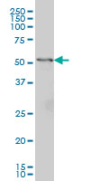 GPT / Alanine Transaminase Antibody - GPT monoclonal antibody (M02A), clone 1F10 Western Blot analysis of GPT expression in HepG2.