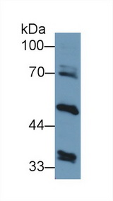 GPT2 / ALT2 Antibody