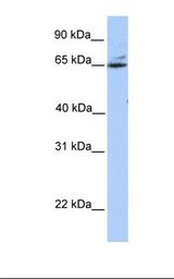 GPT2 / ALT2 Antibody - Fetal brain lysate. Antibody concentration: 1.0 ug/ml. Gel concentration: 12%.  This image was taken for the unconjugated form of this product. Other forms have not been tested.