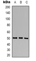GPT2 / ALT2 Antibody - Western blot analysis of ALT2 expression in SHSY5Y (A); HepG2 (B); HEK293T (C) whole cell lysates.