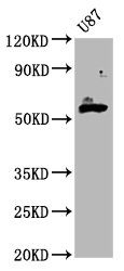 GPT2 / ALT2 Antibody - Western Blot Positive WB detected in: U87 whole cell lysate All Lanes: GPT2 antibody at 4.5µg/ml Secondary Goat polyclonal to rabbit IgG at 1/50000 dilution Predicted band size: 58, 47 KDa Observed band size: 58 KDa