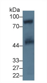 GPV / CD42d Antibody - Western Blot; Sample: Human Platelet lysate; Primary Ab: 5µg/ml Rabbit Anti-Human GP5 Antibody Second Ab: 0.2µg/mL HRP-Linked Caprine Anti-Rabbit IgG Polyclonal Antibody