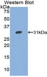 GPV / CD42d Antibody - Western blot of recombinant GPV / CD42d.  This image was taken for the unconjugated form of this product. Other forms have not been tested.