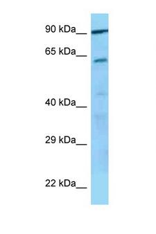 GPV / CD42d Antibody - GP5 / CD42d antibody Western blot of HeLa Cell lysate. Antibody concentration 1 ug/ml.  This image was taken for the unconjugated form of this product. Other forms have not been tested.