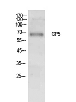 GPV / CD42d Antibody - Western Blot analysis of extracts from Hela cells using GP5 Antibody.