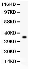 GPX1 / Glutathione Peroxidase Antibody - GPX1 antibody Western blot. All lanes: Anti GPX1 at 0.5 ug/ml. WB: Recombinant Human GPX1 Protein 0.5ng. Predicted band size: 36 kD. Observed band size: 36 kD.