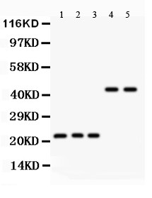 GPX1 / Glutathione Peroxidase Antibody - GPX1 antibody Western blot. All lanes: Anti GPX1 at 0.5 ug/ml. Lane 1: Rat Kidney Tissue Lysate at 50 ug. Lane 2: Mouse Kidney Tissue Lysate at 50 ug. Lane 3: Rat Spleen Tissue Lysate at 50 ug. Lane 4: HELA Whole Cell Lysate at 40 ug. Lane 5: JURKAT Whole Cell Lysate at 40 ug. Predicted band size: 22,44 kD. Observed band size: 22,44 kD.
