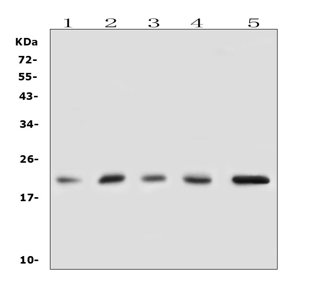 GPX1 / Glutathione Peroxidase Antibody - Western blot analysis of GPX1 using anti-GPX1 antibody. Electrophoresis was performed on a 5-20% SDS-PAGE gel at 70V (Stacking gel) / 90V (Resolving gel) for 2-3 hours. The sample well of each lane was loaded with 50ug of sample under reducing conditions. Lane 1: human THP-1 whole cell lysates, Lane 2: human HL-60 whole cell lysates. Lane 3: human A549 whole cell lysates. Lane 4: rat liver tissue lysates, Lane 5: mouse liver tissue lysates, After Electrophoresis, proteins were transferred to a Nitrocellulose membrane at 150mA for 50-90 minutes. Blocked the membrane with 5% Non-fat Milk/ TBS for 1.5 hour at RT. The membrane was incubated with rabbit anti-GPX1 antigen affinity purified polyclonal antibody at 0.5 µg/mL overnight at 4°C, then washed with TBS-0.1% Tween 3 times with 5 minutes each and probed with a goat anti-rabbit IgG-HRP secondary antibody at a dilution of 1:10000 for 1.5 hour at RT. The signal is developed using an Enhanced Chemiluminescent detection (ECL) kit with Tanon 5200 system. A specific band was detected for GPX1 at approximately 22KD. The expected band size for GPX1 is at 22KD.