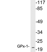 GPX1 / Glutathione Peroxidase Antibody - Western blot analysis of lysates from THP-1 cells, using GPx-1 antibody.