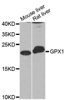 GPX1 / Glutathione Peroxidase Antibody - Western blot analysis of extracts of various cell lines, using GPX1 antibody at 1:1000 dilution. The secondary antibody used was an HRP Goat Anti-Rabbit IgG (H+L) at 1:10000 dilution. Lysates were loaded 25ug per lane and 3% nonfat dry milk in TBST was used for blocking. An ECL Kit was used for detection and the exposure time was 10s.