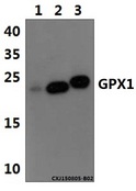 GPX1 / Glutathione Peroxidase Antibody - Western blot of GPX1 antibody at 1:500 dilution. Lane 1: THP-1 whole cell lysate (60 ug). Lane 2: The Liver tissue lysate of Mouse(40 ug). Lane 3: The Liver tissue lysate of Rat(40 ug).