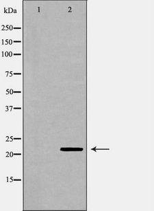 GPX1 / Glutathione Peroxidase Antibody - Western blot analysis of mouse liver tissue lysates using GPX1 antibody. The lane on the left is treated with the antigen-specific peptide.
