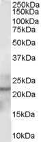 GPX2 Antibody - Antibody staining (1 ug/ml) of Human Prostate lysate (RIPA buffer, 30 ug total protein per lane). Primary incubated for 1 hour. Detected by Western blot of chemiluminescence.