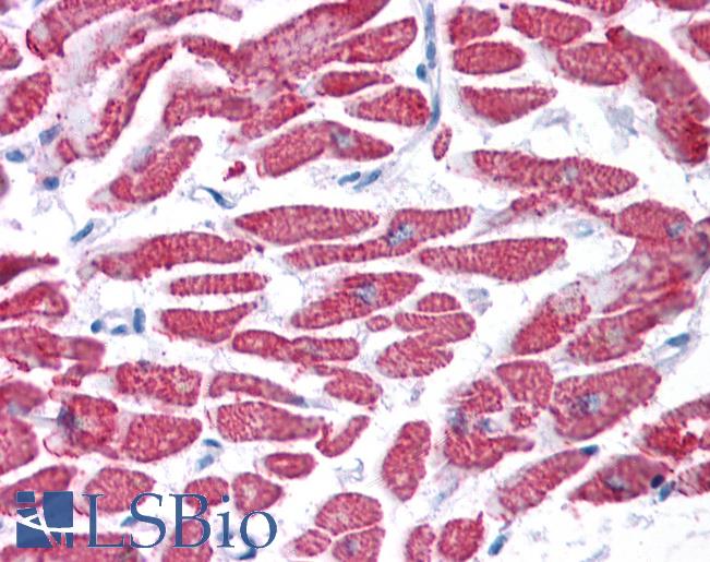 GPX4 / MCSP Antibody - Anti-GPX4 antibody IHC of human heart. Immunohistochemistry of formalin-fixed, paraffin-embedded tissue after heat-induced antigen retrieval. Antibody concentration 5 ug/ml.  This image was taken for the unconjugated form of this product. Other forms have not been tested.