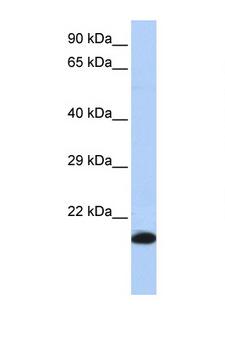 GPX4 / MCSP Antibody - GPX4 antibody Western blot of HepG2 Cell lysate. Antibody concentration 1 ug/ml. This image was taken for the unconjugated form of this product. Other forms have not been tested.