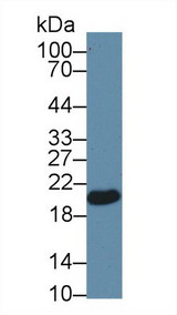 GPX4 / MCSP Antibody - Western Blot; Sample: Human Liver lysate; Primary Ab: 1µg/ml Rabbit Anti-Human GPX4 Antibody Second Ab: 0.2µg/mL HRP-Linked Caprine Anti-Rabbit IgG Polyclonal Antibody