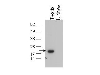 GPX4 / MCSP Antibody - Anti-GPx4 Antibody - Western Blot. Western blot of affinity purified anti-GPx4 to detect GPx4 in testis extract (arrow). tissue extract (40 ug) was electrophoresed and transferred to nitrocellulose. The membrane was probed with the primary antibody at a 1:1000 dilution. Personal Communication, Dolph Hatfield, CCR-NCI, Bethesda, MD.