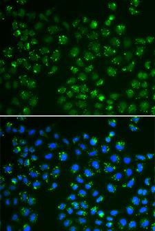 GPX4 / MCSP Antibody - Immunofluorescence analysis of A549 cells.