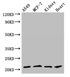 GPX4 / MCSP Antibody - Positive WB detected in:A549 whole cell lysate,MCF-7 whole cell lysate,Mouse kidney tissue,Rat heart tissue;All lanes:GPX4 antibody at 3.5?g/ml;Secondary;Goat polyclonal to rabbit IgG at 1/50000 dilution;Predicted band size: 23,20 KDa;Observed band size: 23 KDa;